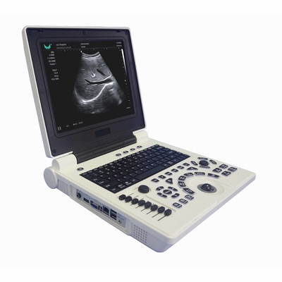 Macchina portatile di ultrasuono di doppler di colore di OB'GYN nella gravidanza