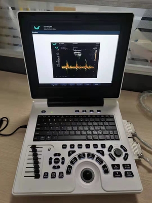 Macchina portatile di ecografia della macchina di ultrasuono oftalmico USG di PW