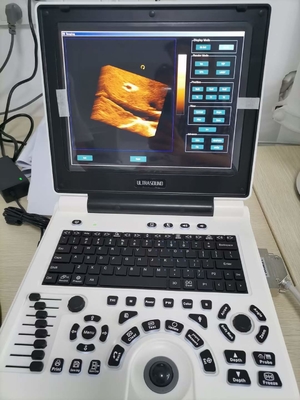 L'ultrasuono di doppler di colore di gravidanza di Xianfeng lavora l'OEM a macchina di immagini 4B