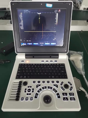 Strumento medico 64G di ultrasuono 3D di DICOM di doppler portatile della macchina