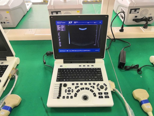 macchina diagnostica Li Battery dell'analizzatore di ultrasuono di tecnologia di 12.1in