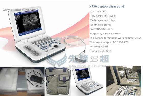 Porta USB domestica medica di rappresentazione della macchina DRF RDA di ultrasuono di gravidanza