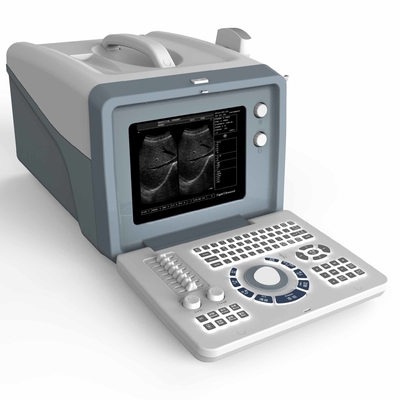L'ultrasuono portatile del FSC 3D 4D MSK lavora il trasporto a macchina Vigianl di ricerca