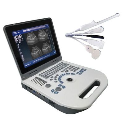 Qualità  TGC Control Notebook Ultrasound Scanner For Pregnancy Home Use Fabbrica