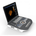 Ecografia portatile di Digital di colore 4D di doppler dell'attrezzatura medica di ultrasuono