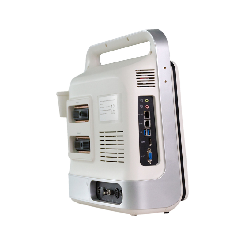Controllo portatile della macchina TGC di ultrasuono di doppler di colore del computer portatile per il cuore dei neonati