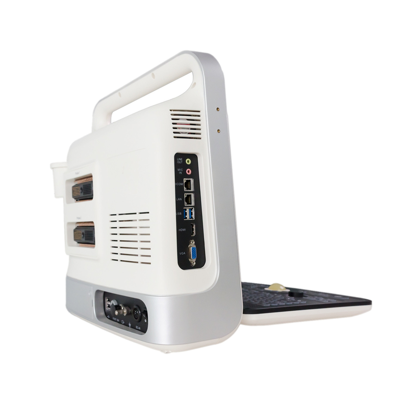 Controllo portatile della macchina TGC di ultrasuono di doppler di colore del computer portatile per il cuore dei neonati