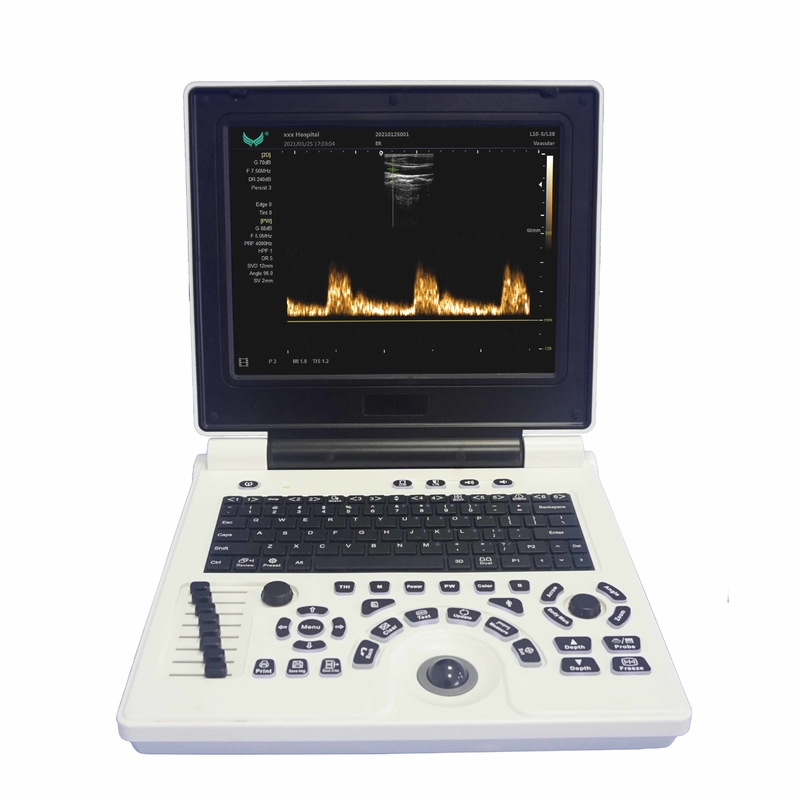 Macchina portatile di ultrasuono di doppler di colore di OB'GYN nella gravidanza
