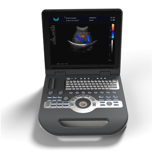 Dispositivo tenuto in mano di ultrasuono di doppler dell'analizzatore 220V di ultrasuono di colore di cardiologia dello SGS