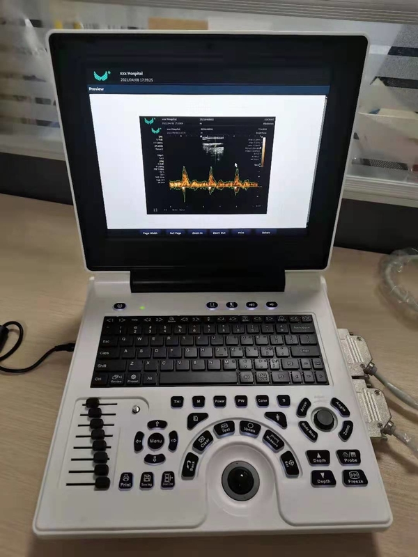 L'ultrasuono di doppler di colore di gravidanza di Xianfeng lavora l'OEM a macchina di immagini 4B