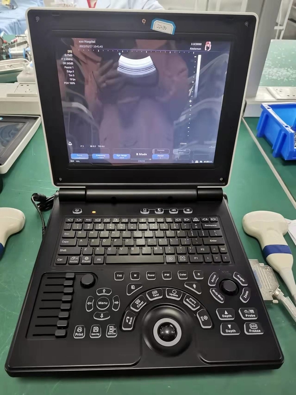Sistema portatile livellato di base di ultrasuono di doppler di colore di Digital della macchina di iso USG