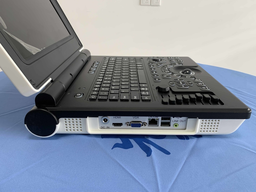 Batteria portatile dell'analizzatore 3200mAh di ultrasuono di doppler di colore del sistema Win7
