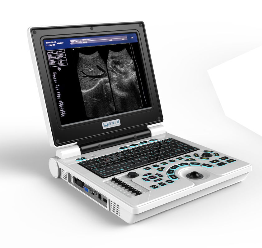 Advanced Technology Ultrasound Scanning Machine with 4 Focus and Long-Lasting Li-ion Battery