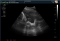 Porta USB domestica medica di rappresentazione della macchina DRF RDA di ultrasuono di gravidanza