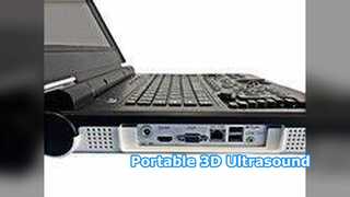 Ecografo portatile E20 Ospedale clinico