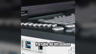 Macchina portatile per ultrasuoni Doppler 4D pronta per l'unità di terapia intensiva
