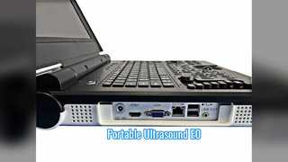 Ecografia portatile Color Doppler E0 per scansione urologica