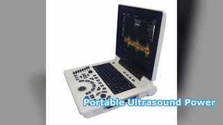 Macchina per ultrasuoni portatile Diagnosi OB GYN